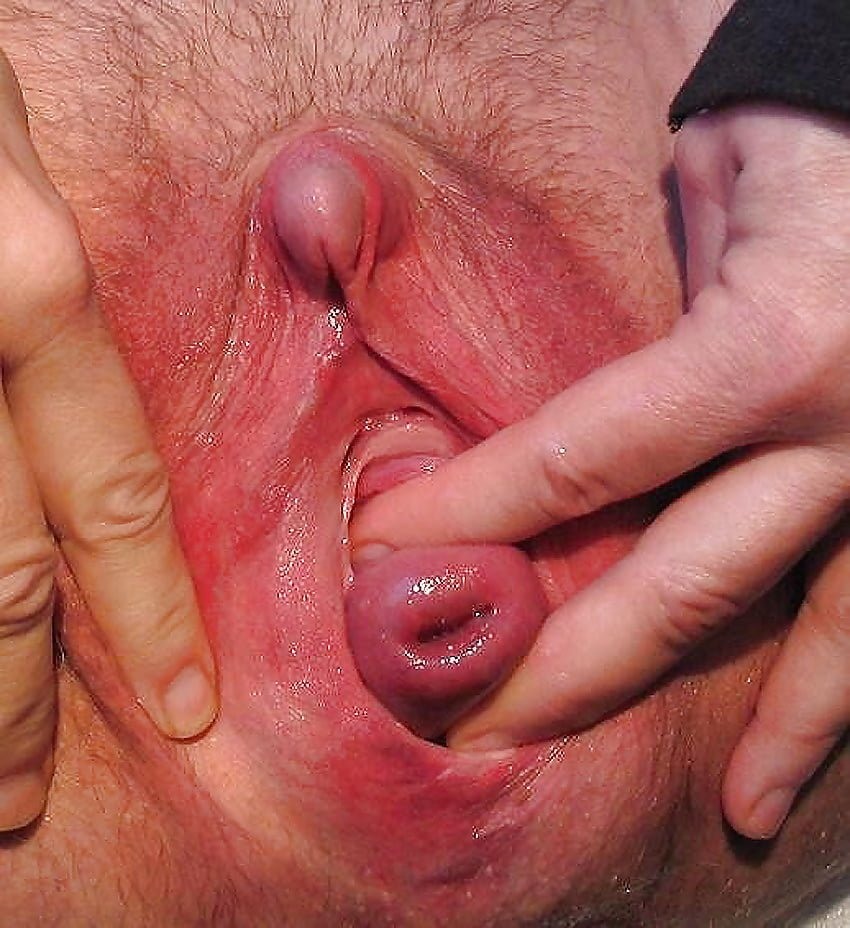 The insides of the vagina