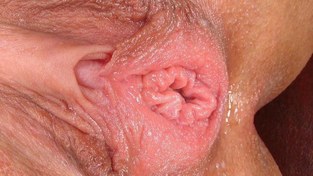 Large small labia