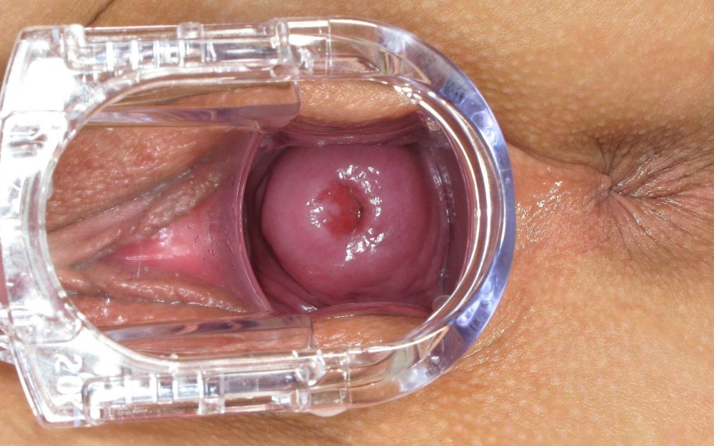 Items inside the vagina