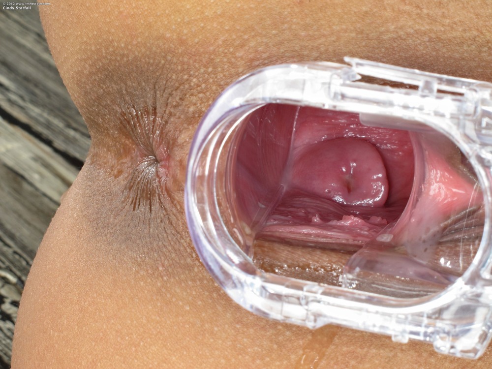 The camera inside the vagina