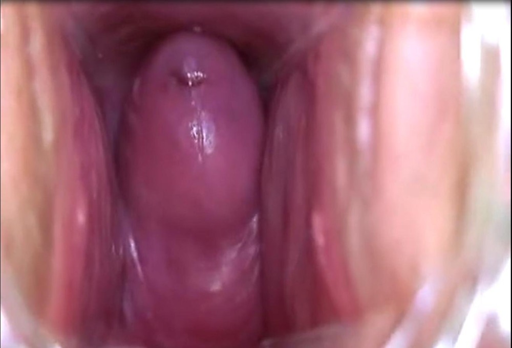 Member inside the vagina from the inside