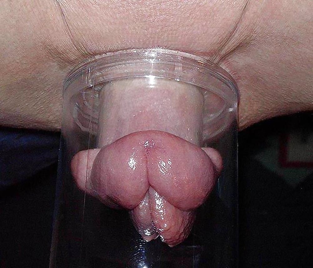 Vagina after a vacuum pump