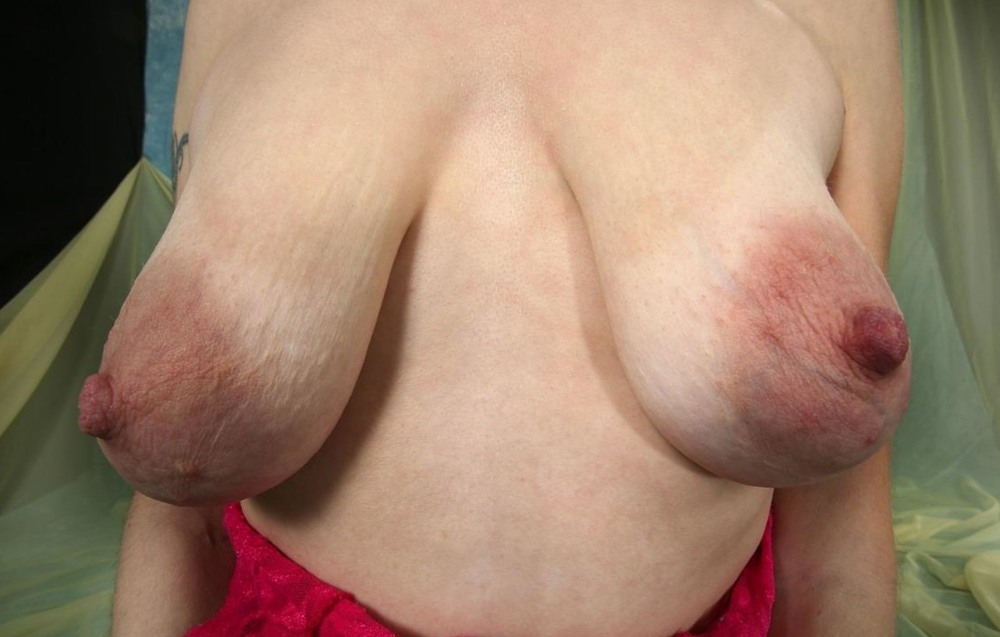 The largest boobs in the world