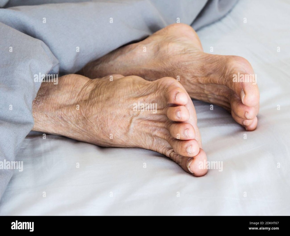 The legs of the elderly