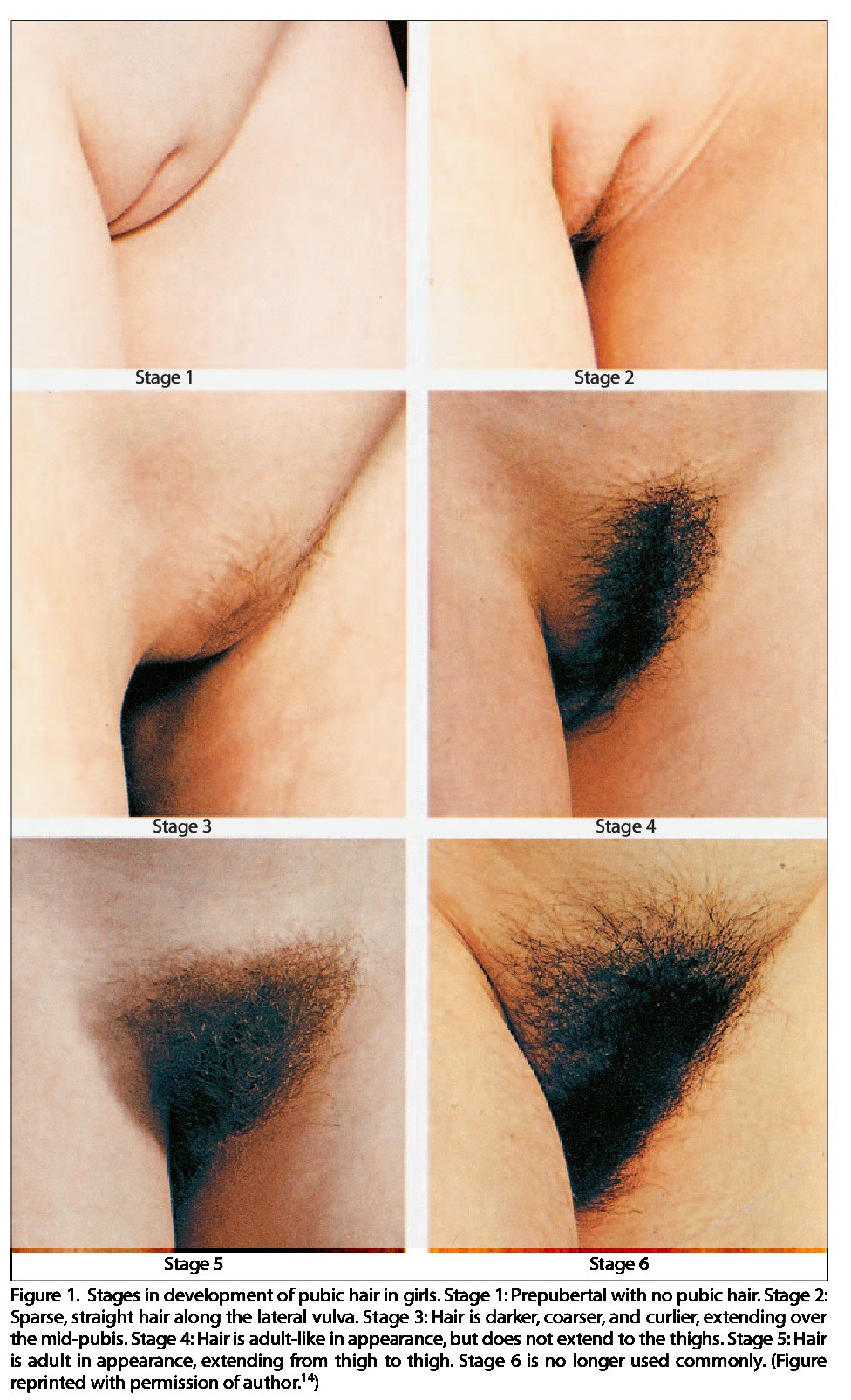 Early sexual growth