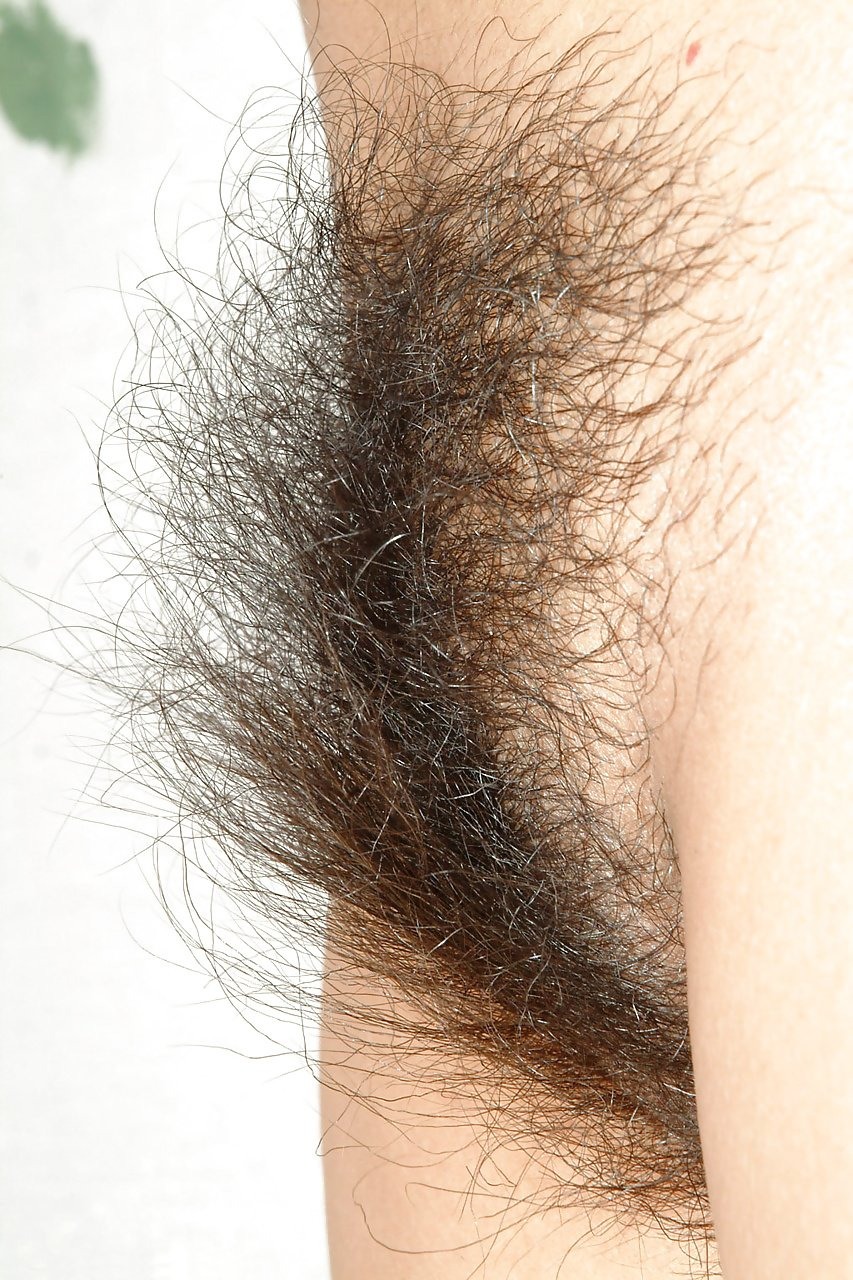 The most hairy female pubis