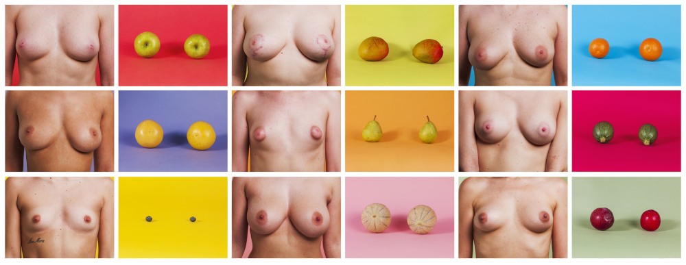 Cone -shaped breasts