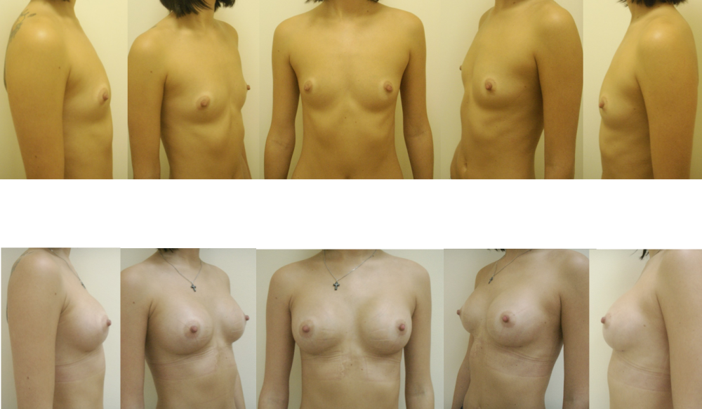Naked boobs of various shapes