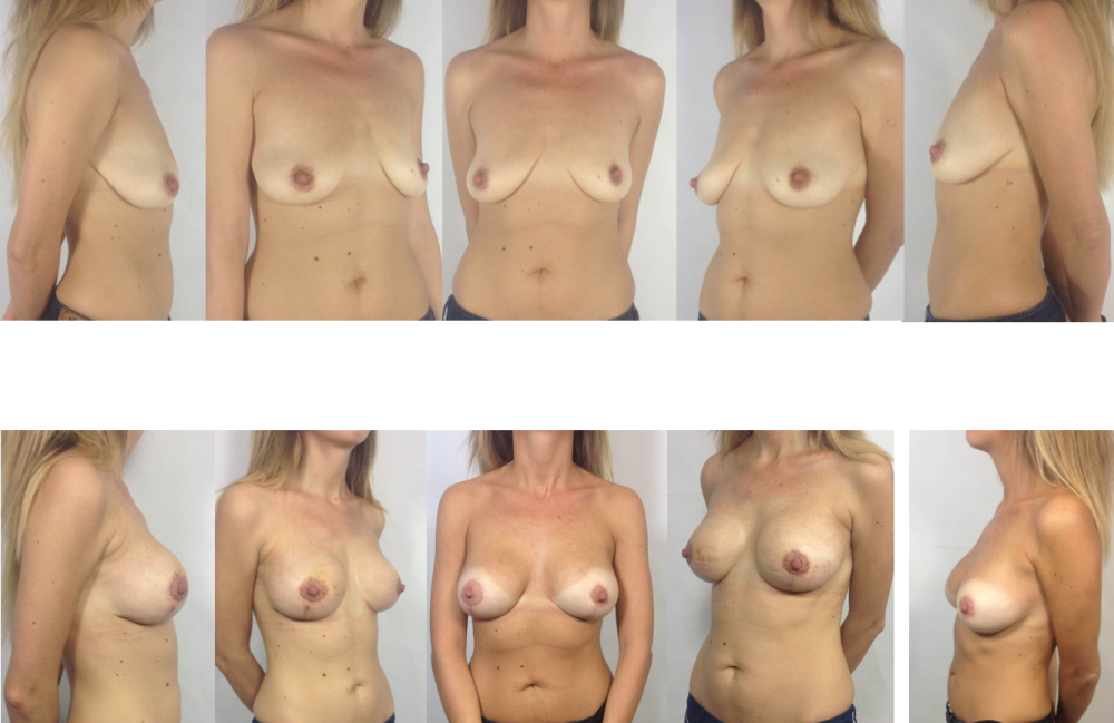 Naked boobs of all sizes
