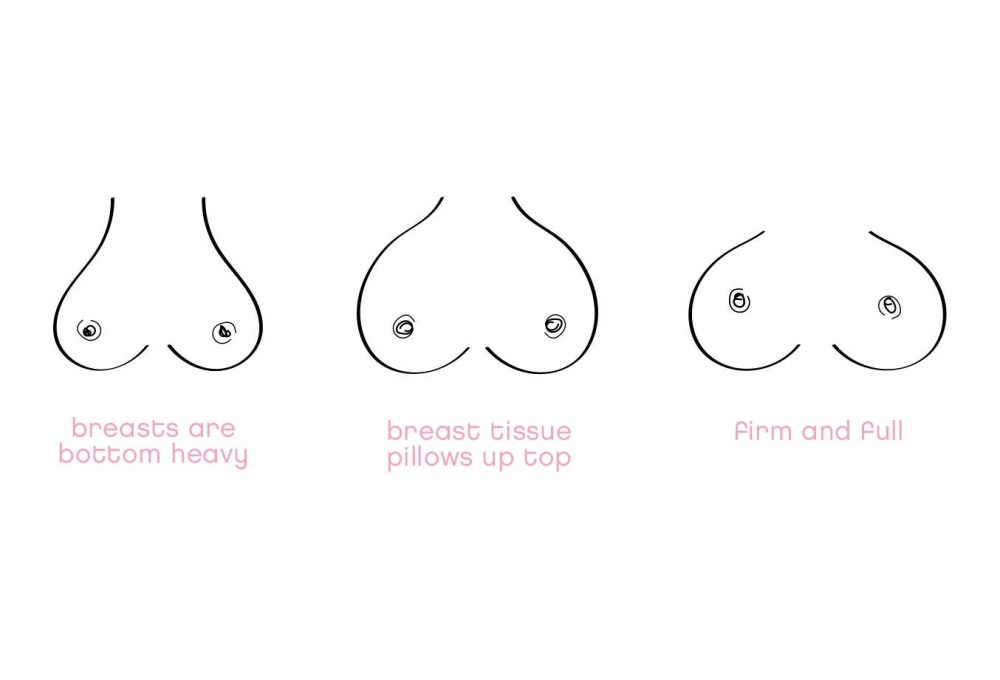 Huge nipples of female breasts