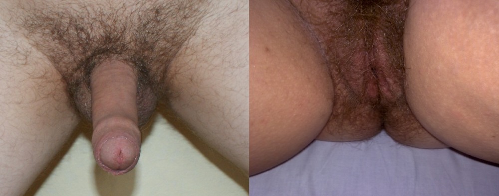 The largest male pubic hair