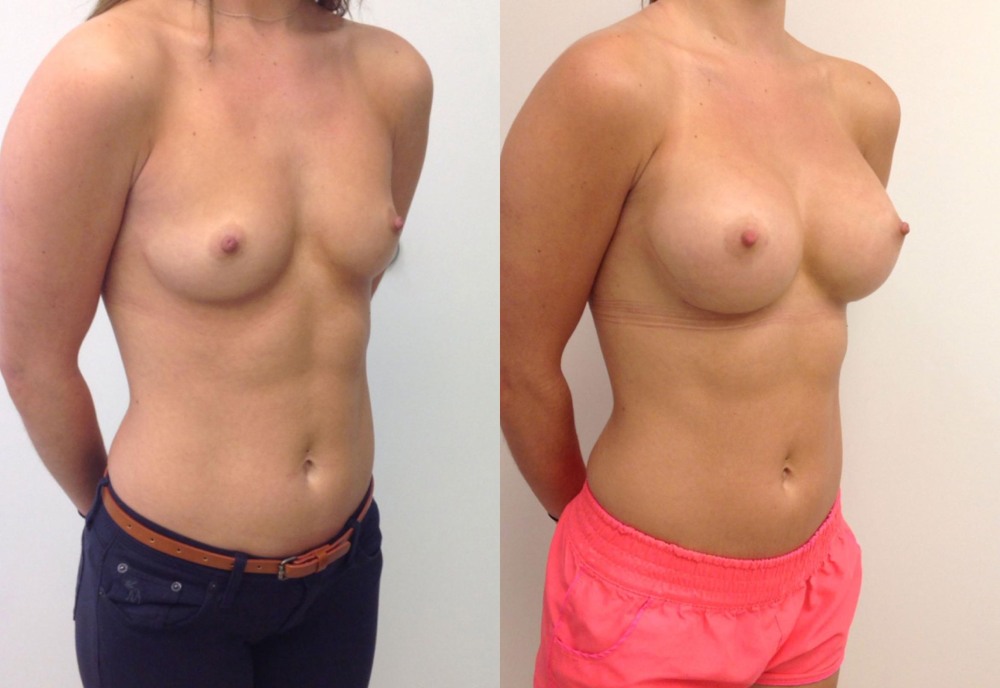 Gorgeous standing chest