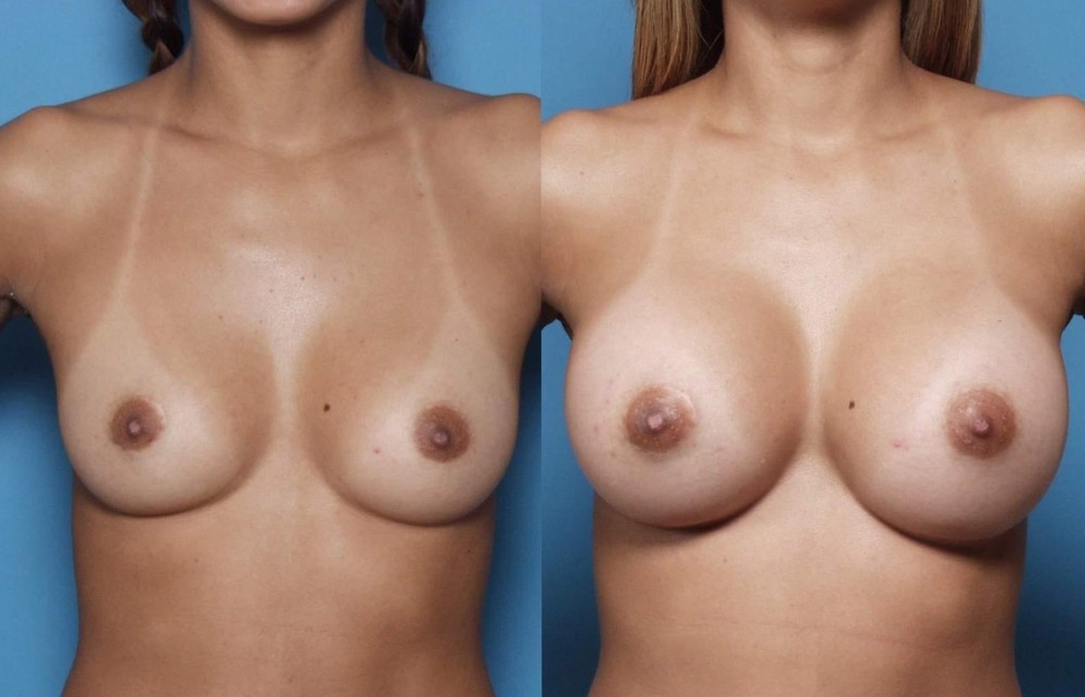 Beauties with small boobs in swimsuits
