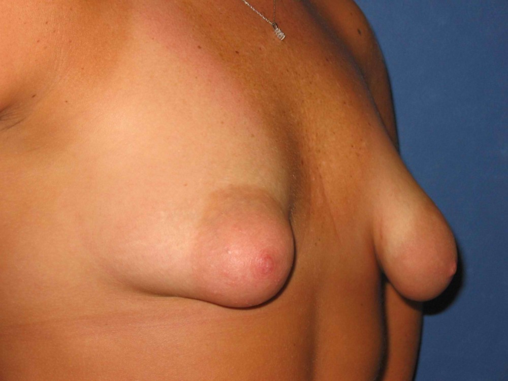 Little tanned chest