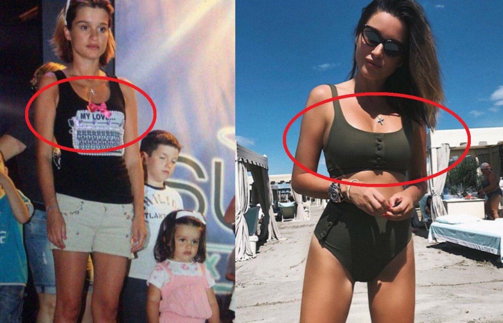 Plastic surgery of Borodina Ksenia