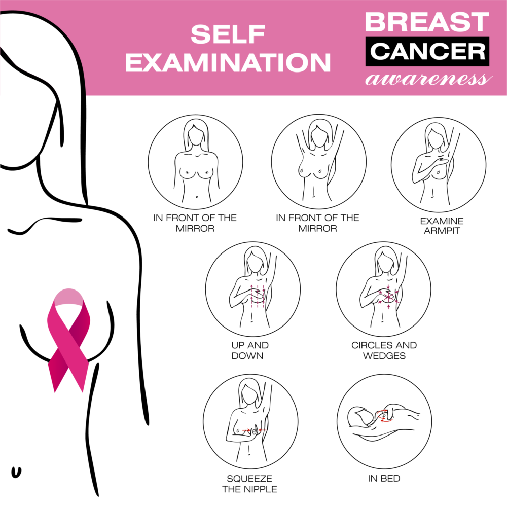 Breast enlargement is schematical
