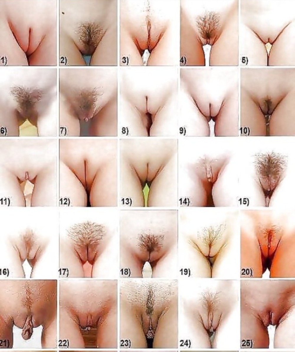 Different forms of female genitals
