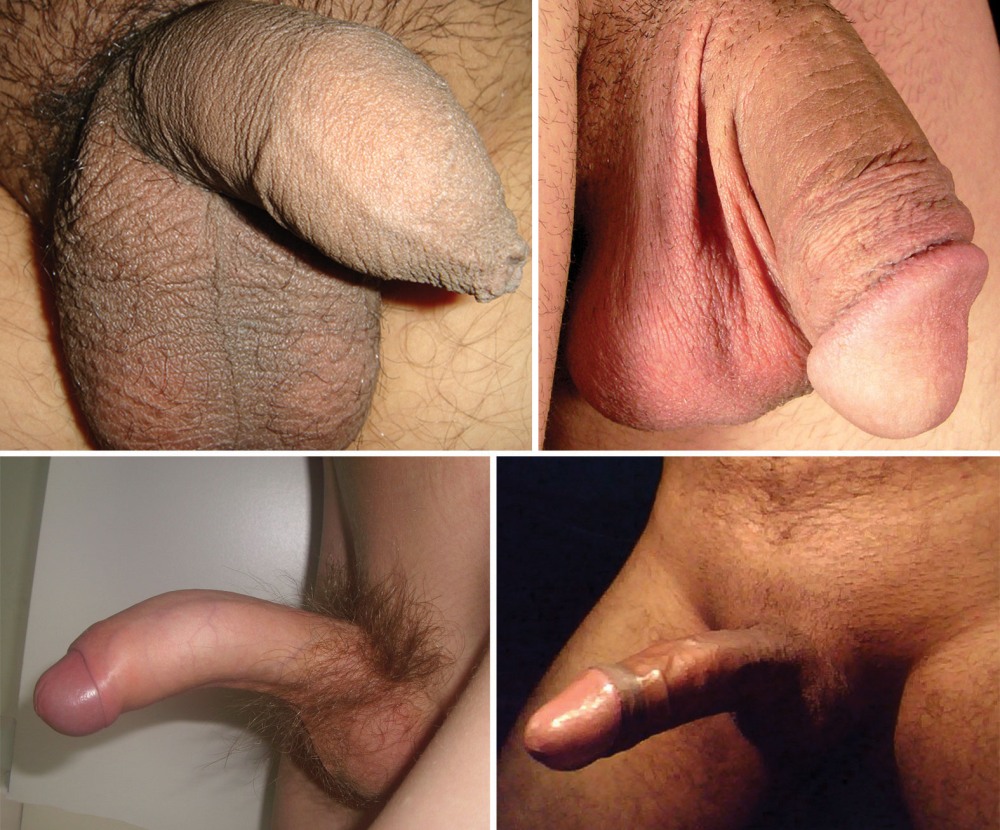 Male penis without erection