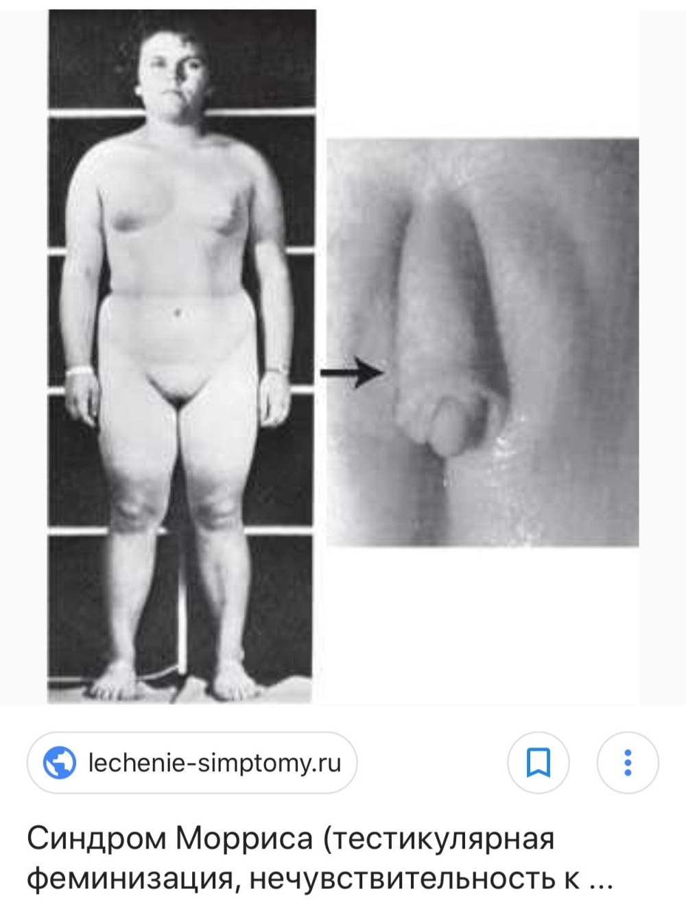 Puberty nude