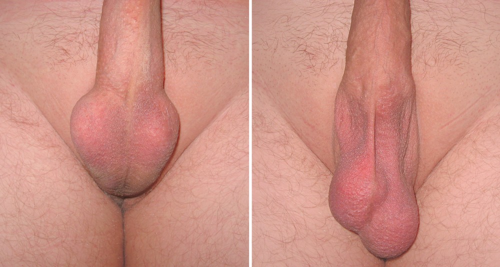 Naked women in front and back