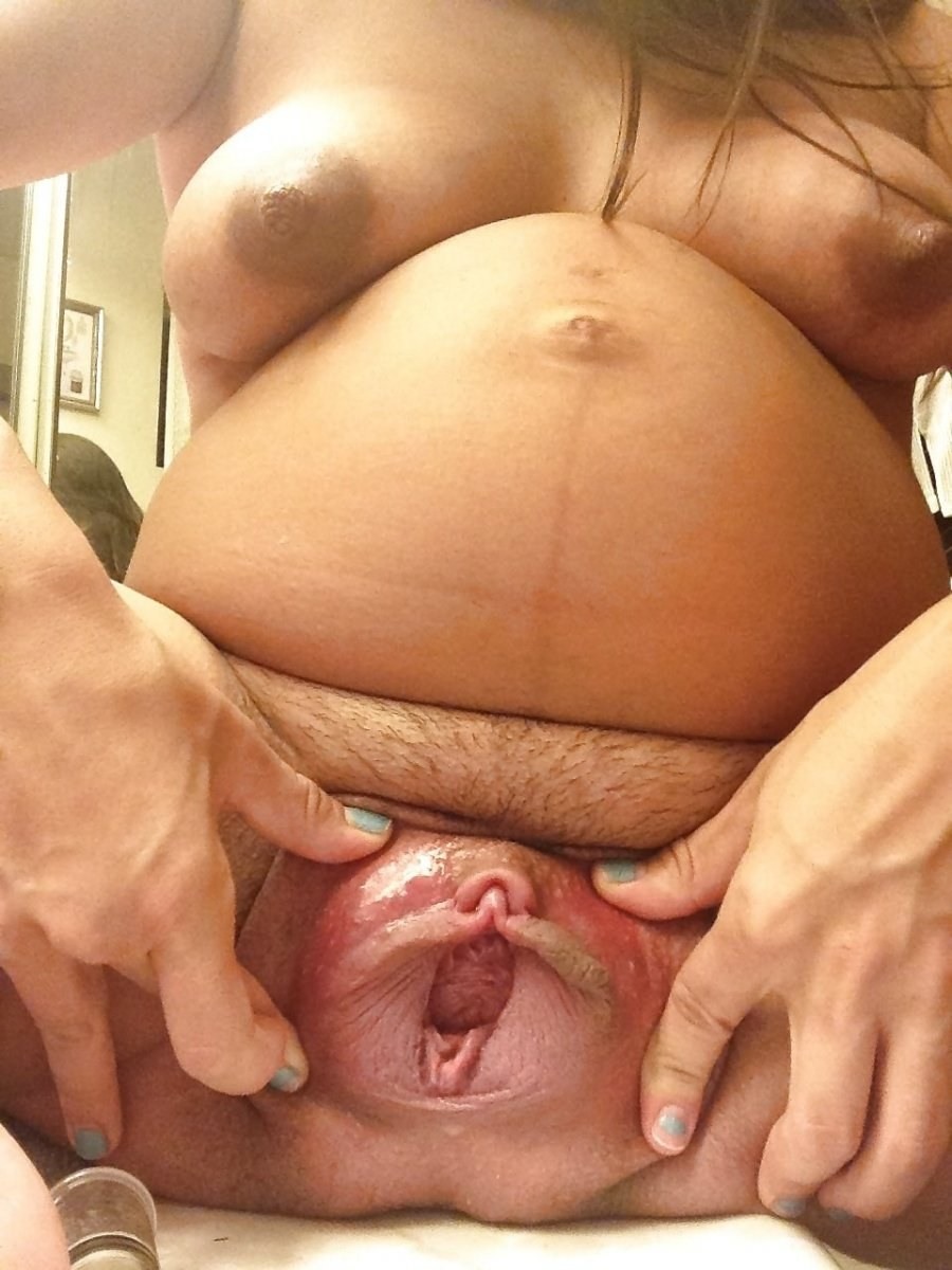 Uterus and vagina after childbirth